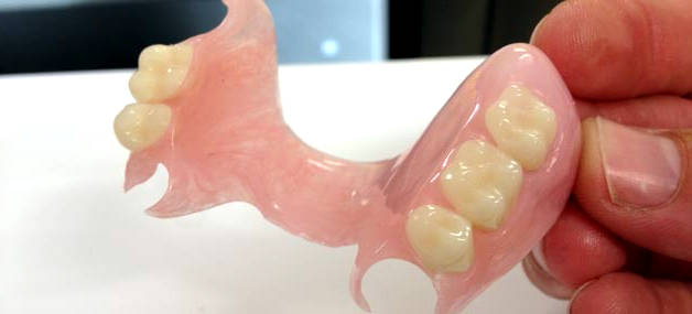 Силіконові зубні протези: що це, догляд, ціни, відгуки » журнал здоров'я iHealth 
