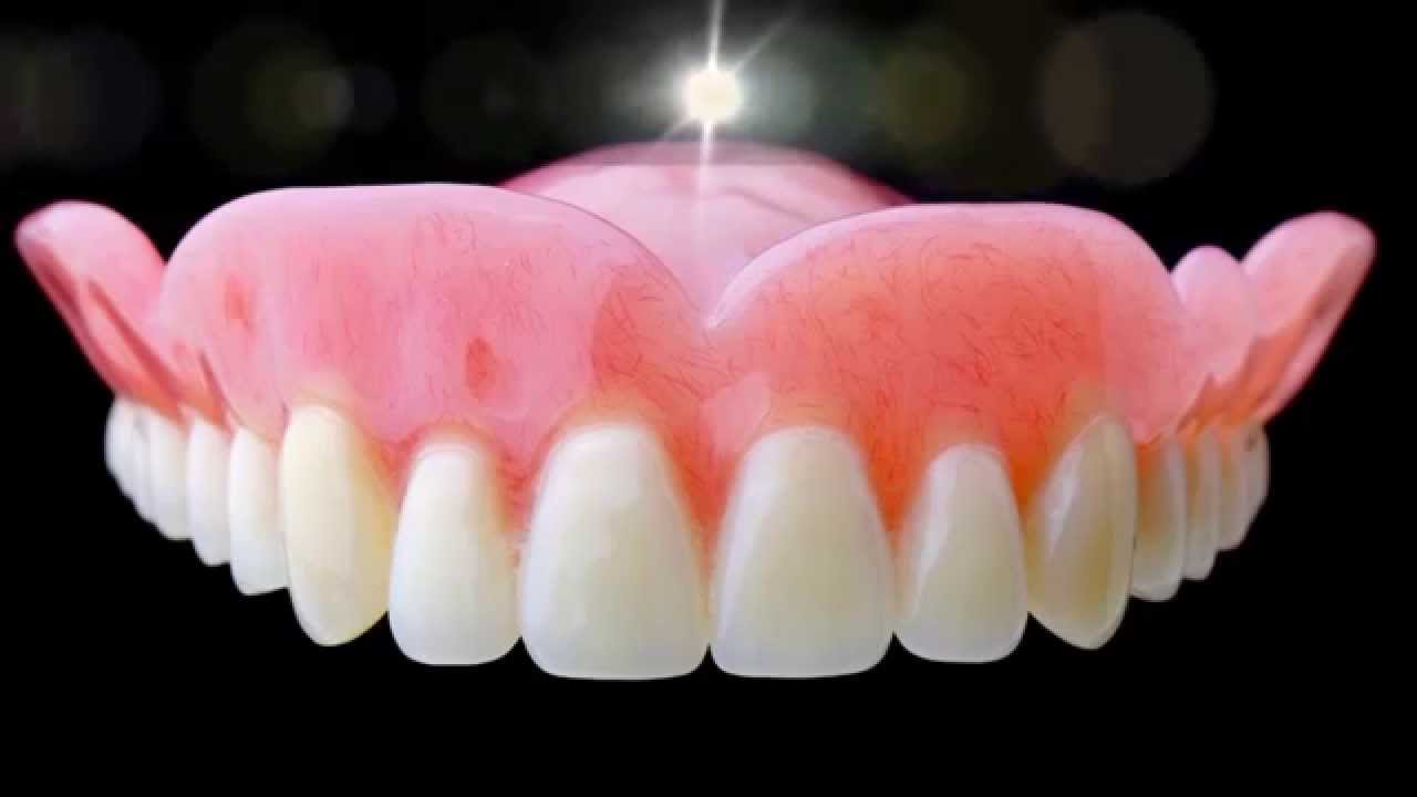 Акрилові зубні протези: що це таке, відгуки і ціни » журнал здоров'я iHealth 