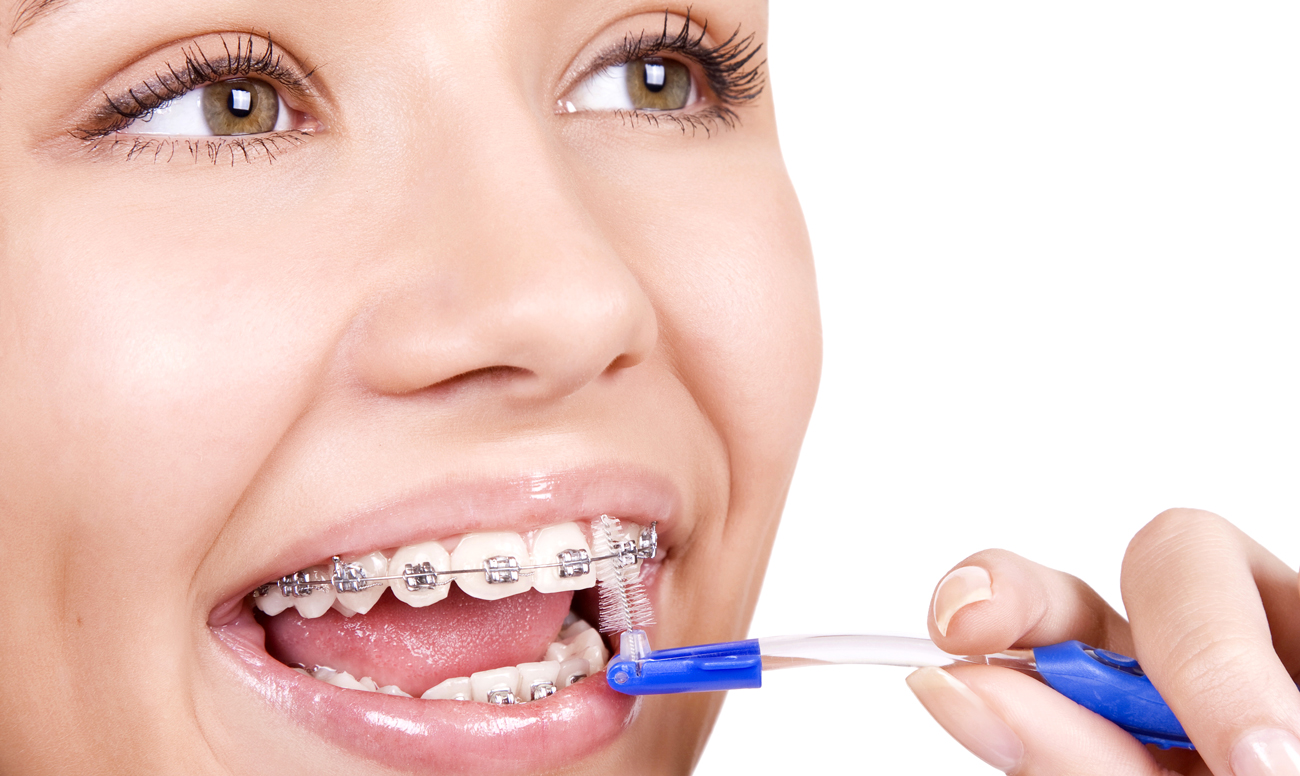 Как чистить зубы с брекетами ершиком?