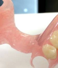 Силиконовые зубные протезы - фото