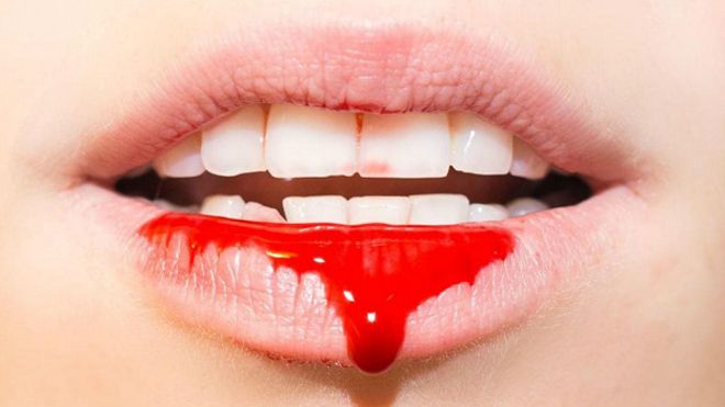 Привкус крови во рту - причины