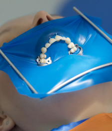 Коффердам в стоматологии - что это такое?