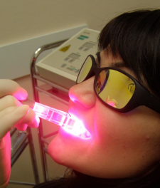 Как проводят процедуру лазерного отбеливания?