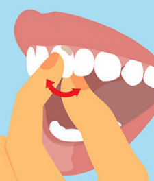 Как лечить подвижность зубов?